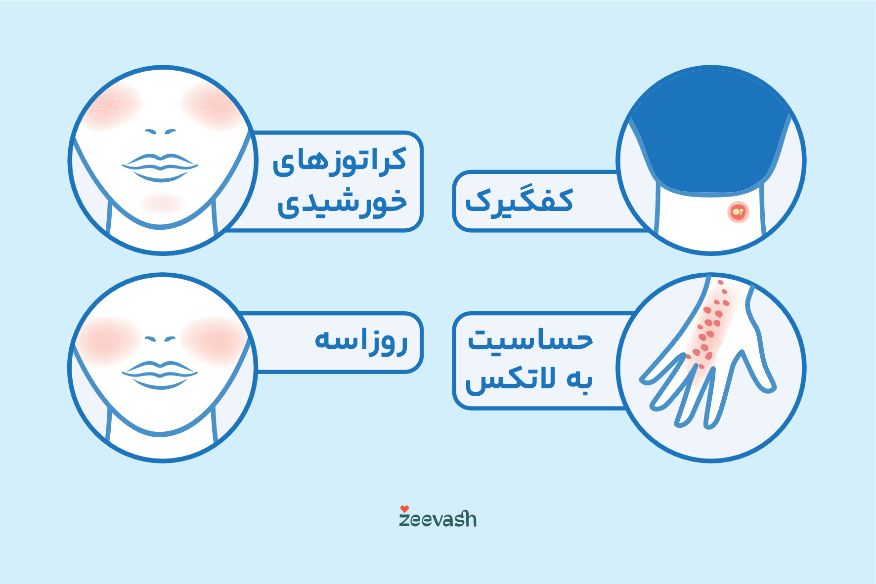 تصاویر التهاب پوستی - روزاسه کفیگرک کراتوز حساسیت به لاتکس